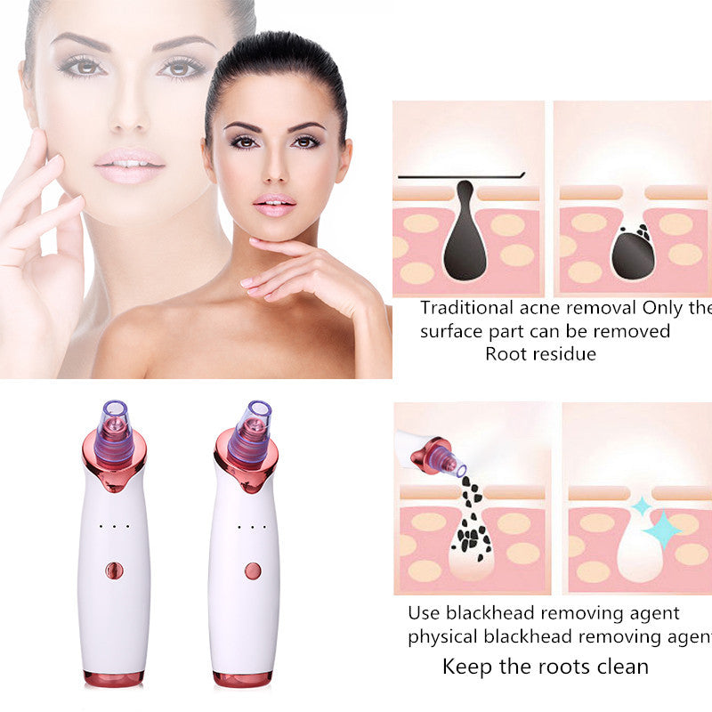 Instant Glow, Blackhead & Pore Vacuum Cleaner